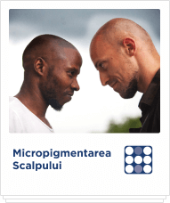 Micropigmentare Scalp Scalp Micropigmentation Hairodot